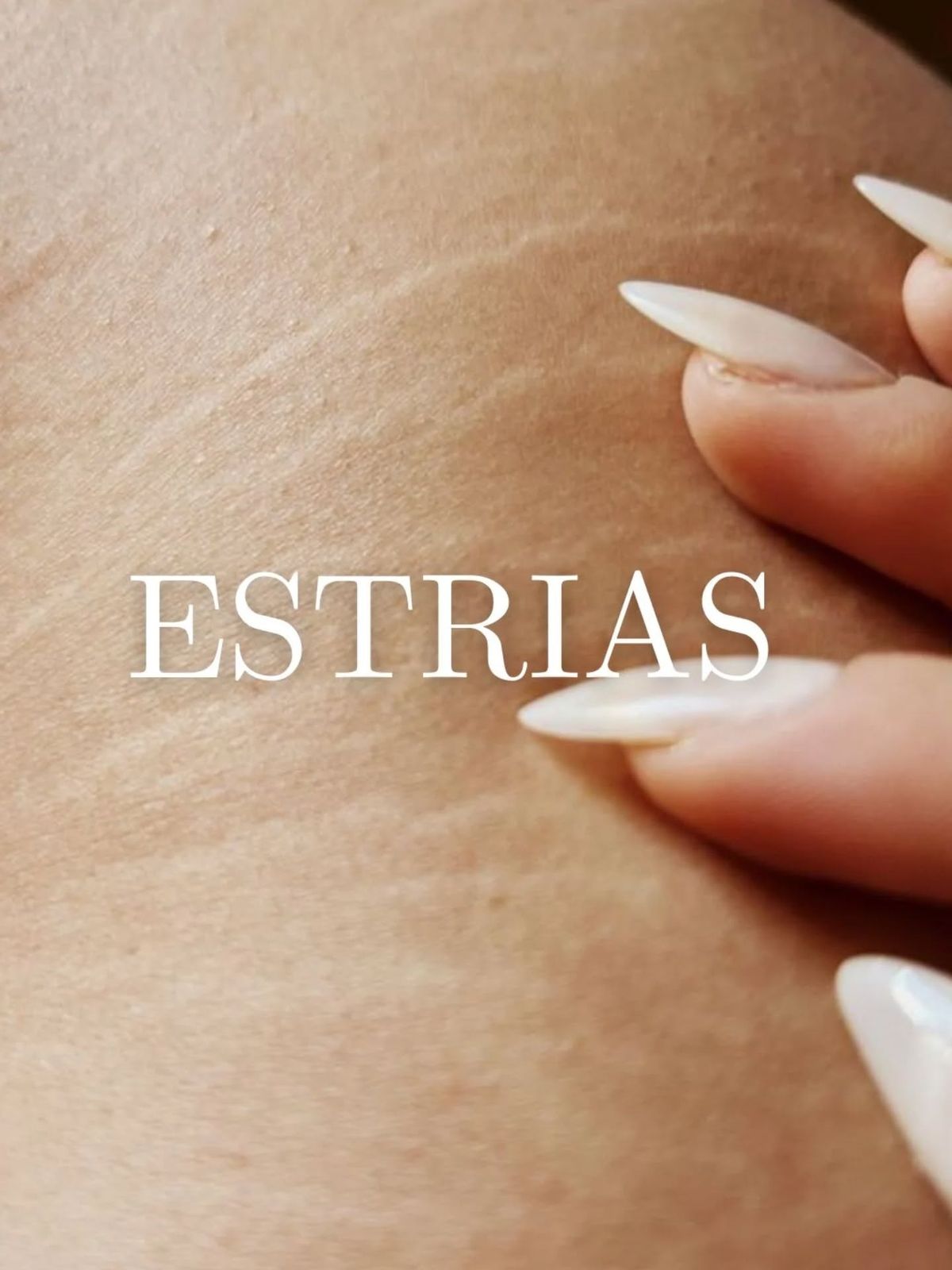 Restauración de Cicatrices y Estrías - detalle