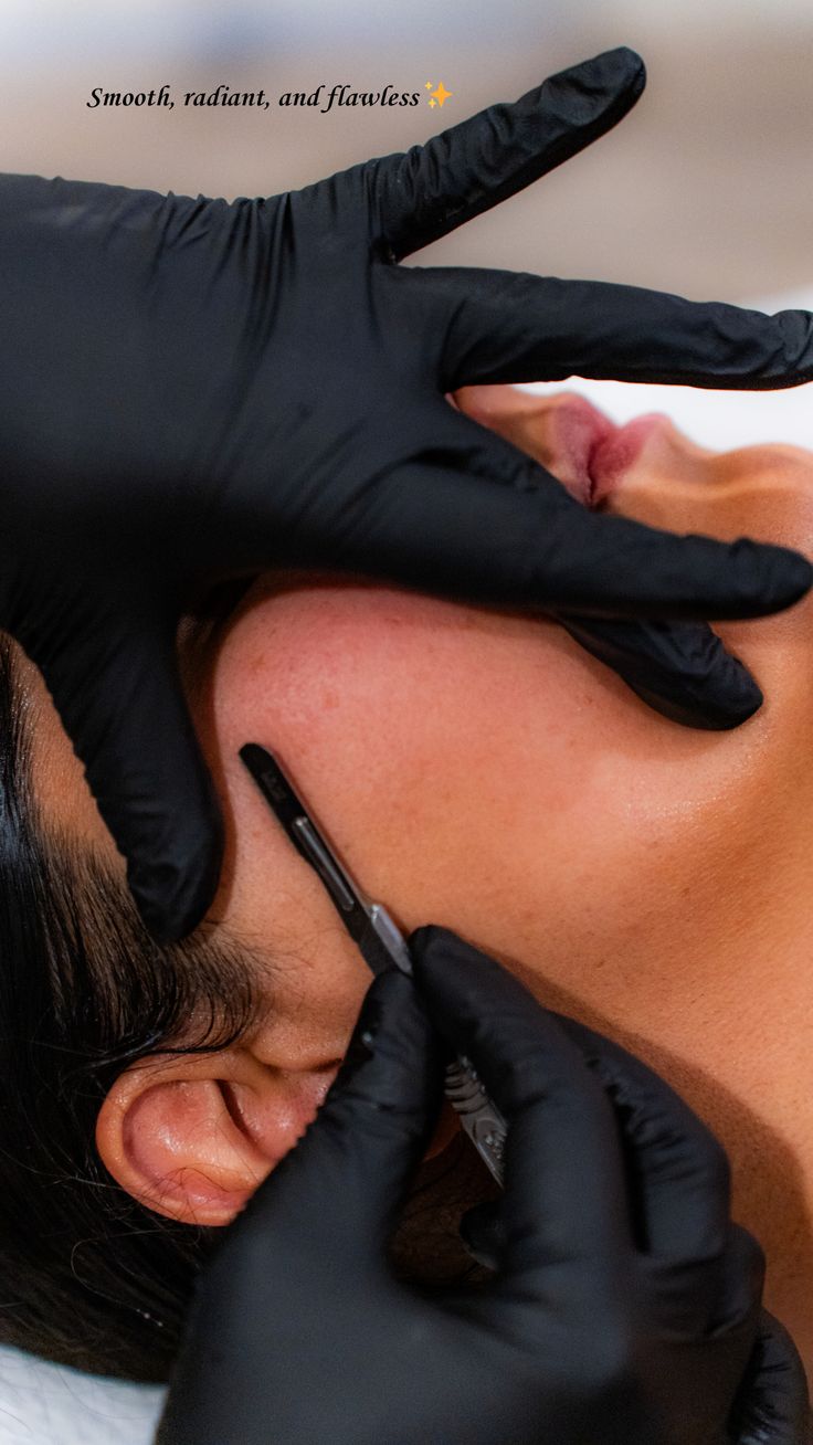 Dermaplaning - detalle